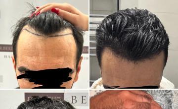 1.370 Grafts Dr. Bekir Bek