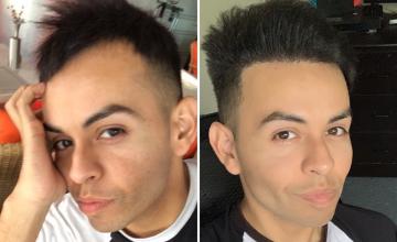 Before and after 