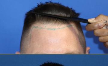 Before and After 
