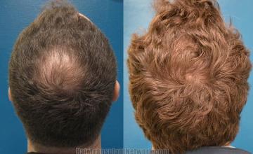  before and after photos