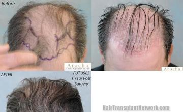  before and after images